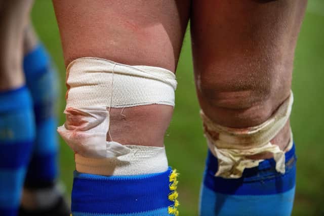Both sides could be seen wearing bandages. (Photo: Bruce Rollinson)