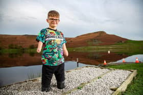 Luke Mortimer, a selfless ten-year-old quad amputee, at the bottom of Embsay Crag, in North Yorkshire.