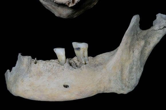 The teeth reveal the surprising diet of our ancestors