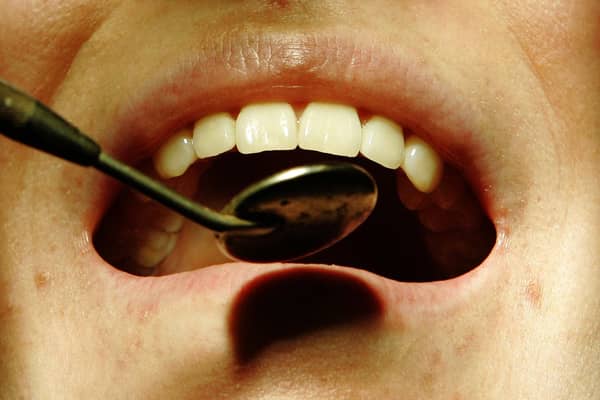 A patient having their teeth examined while sitting in a dentist's chair, as the number of "dental deserts" is growing across England, according to a new analysis.