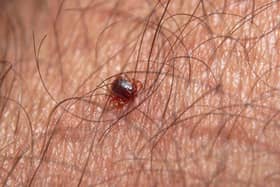 Ticks can sometimes be very small and hard to spot.