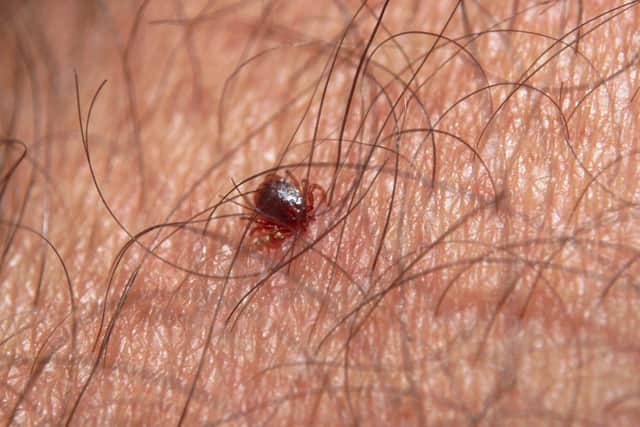 Ticks can sometimes be very small and hard to spot.