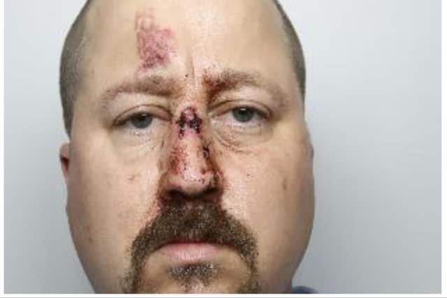 Kieran Kenny was found covered in blood injured in East Lane, Stainforth, on 9 September 2022. He appeared to be intoxicated to the point that he had fallen over and injured his face and there were no signs of any altercation with others.