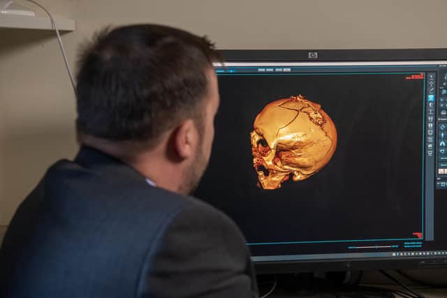 Chief technology officer Tony Healy ooking at images from a CT scanner of a male killed by gunshot wounds photographed for The Yorkshire Post by Tony Johnson.