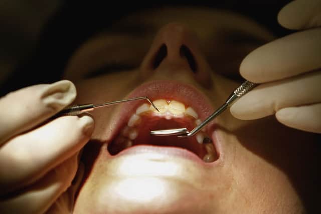 The cross-party group of MPs also heard first-hand experience of members of the public extracting their own teeth at home, while others were forced to travel hours for appointments.