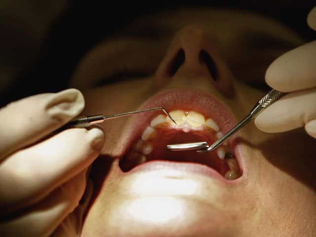 The cross-party group of MPs also heard first-hand experience of members of the public extracting their own teeth at home, while others were forced to travel hours for appointments.