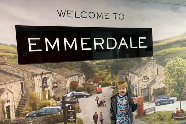 Dexter's first acting role was in Emmerdale.