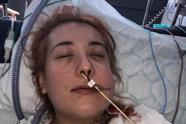 Jordan Del’Nero during her treatment for salivary gland cancer.