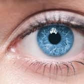 Around 5% of the total blind population in the world have corneal blindness.