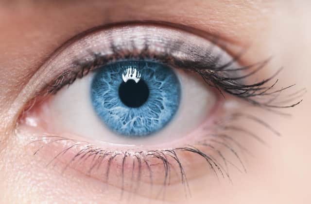 Around 5% of the total blind population in the world have corneal blindness.