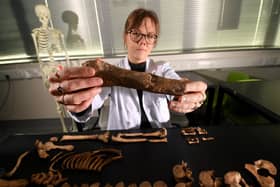 Nina Maaranen human Osteology teaching technician is pictured with a femur from the rare and unusual life of an anchoress, a woman who devoted her life to prayer while living in seclusion, has been unearthed by the University of Sheffield
 Picture by Simon Hulme