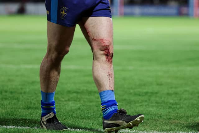 Blood is seen on the knee of Wakefield’s Lee Kershaw. (Photo: Alex Whitehead/SWpix.com)