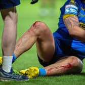 Kevin Proctor's knees at the end of the game against Huddersfield Giants. (Photo: Bruce Rollinson)