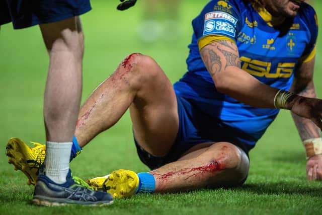 Kevin Proctor's knees at the end of the game against Huddersfield Giants. (Photo: Bruce Rollinson)