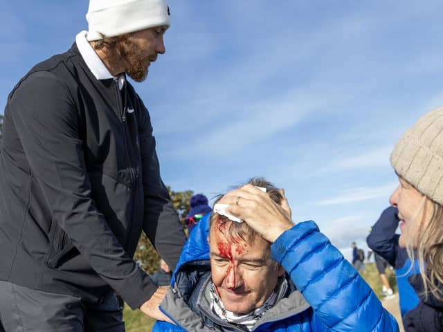 Concern: Tommy Fleetwood speaks to Andrew Summerskill from Yorkshire after his ball struck him on the head during day two of the 2023 Alfred Dunhill Links Championship at Kingsbarns. (Picture: Robert Perry/PA Wire)