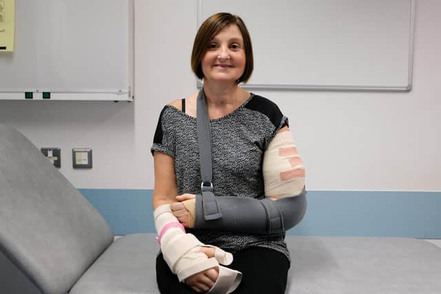 Tania Jackson, 42, underwent the incredible 15-hour procedure in September after she lost both hands and her left arm to sepsis.