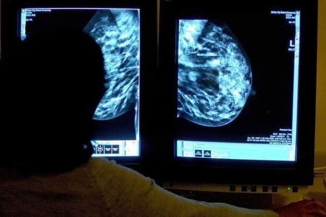Breast cancer targets are being missed in Leeds.