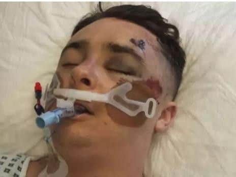 Gareth Edwards, 48, of Bramley, Leeds photographed his 19-year-old son Josh at St Jamess Hospital with the intention of sharing the picture to raise awareness of the devastating consequences drugs can have.