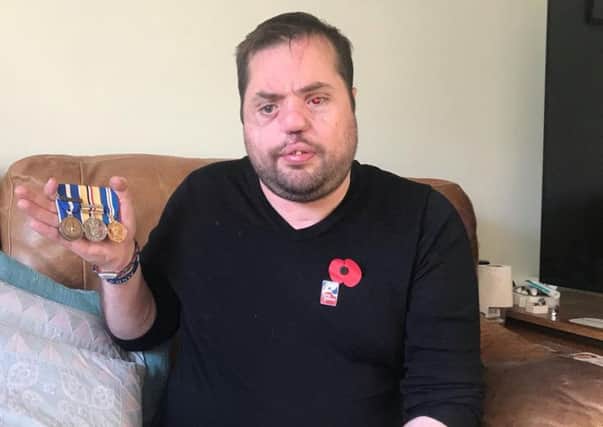 Undated handout photo of Simon Brown, 39, holds the three medals won during his time with the Army. He served in the Royal Electrical and Mechanical Engineers, before nearly losing his eyesight when he was hit by sniper fire in Basra in 2006. PRESS ASSOCIATION Photo. Issue date: Wednesday November 7, 2018. See PA story MEMORIAL Armistice Brown. Photo credit should read: Handout/PA Wire

NOTE TO EDITORS: This handout photo may only be used in for editorial reporting purposes for the contemporaneous illustration of events, things or the people in the image or facts mentioned in the caption. Reuse of the picture may require further permission from the copyright holder.