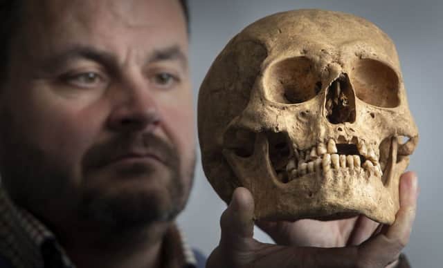Dr Hugh Willmott holds a human skull that was discovered during excavations at a previously unknown Anglo-Saxon cemetery that unearthed lavish burials of women with their jewellery and personal items.