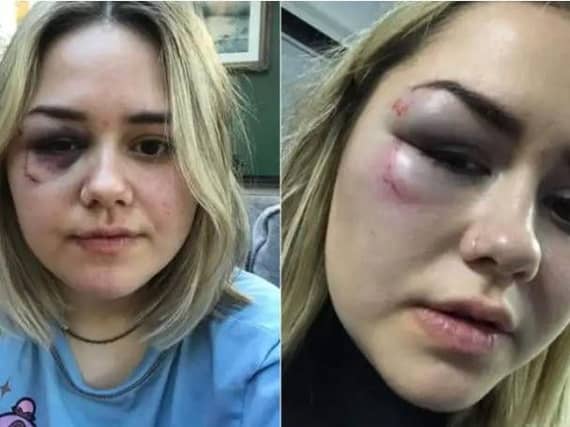 Billy, who plays for Northampton Town, said that 'a complete stranger' punched his sister near the bus station.