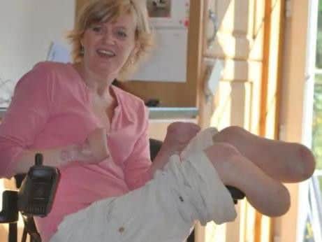 The single mother, from Renfrewshire in Scotland, lost her hands and feet in 2013 after suffering acute pneumonia and sepsis, which nearly killed her.