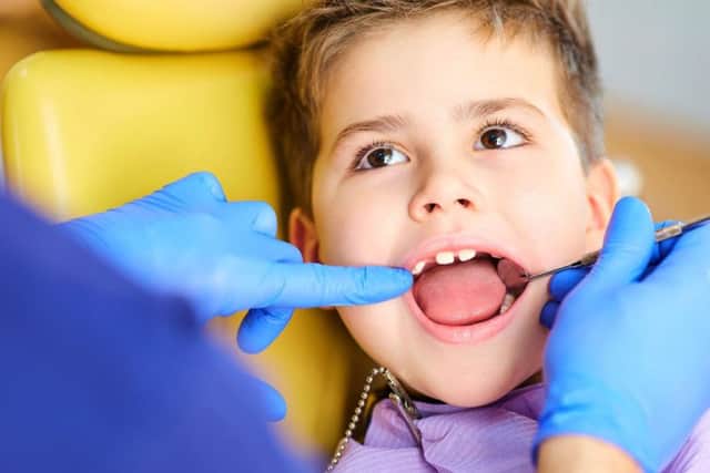 Young children in Leeds are less likely to get tooth decay than they were 10 years ago.