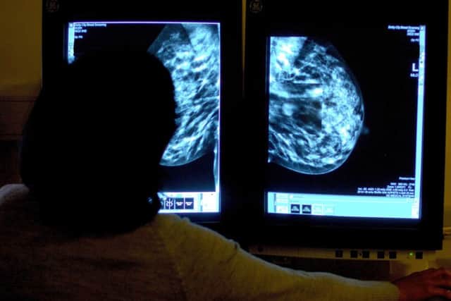 Breast screening appointments are vital to the health of women, according to campaigners.