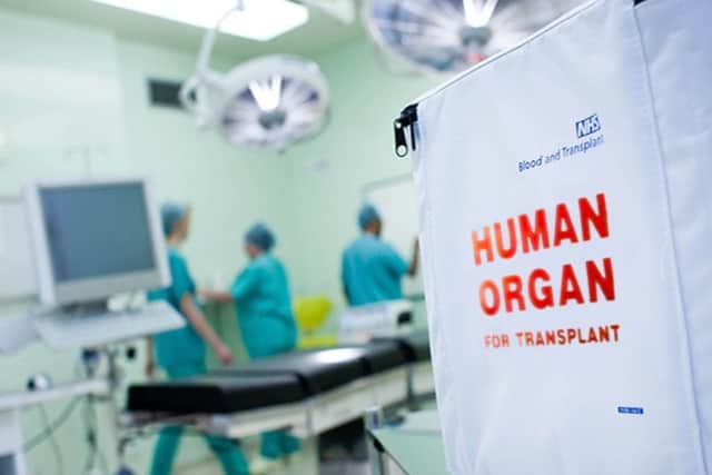 Organ donation.