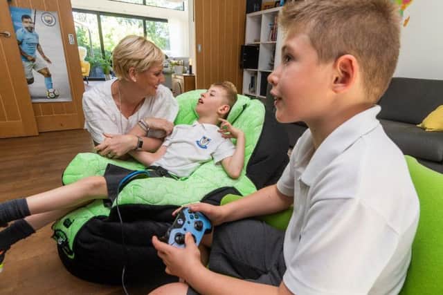 With the help of advanced technology, Kit can play Xbox with his brother Oliver