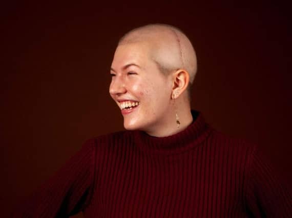 Emeline Gilhooley took part in a professional photoshoot not long after her brain tumour surgery. Picture by Sophie Mayanne
