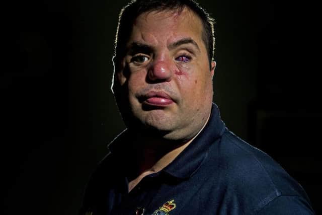 Iraq veteran Simon Brown, representing Blind Veterans UK, will march at the Cenotaph in London to mark Remembrance Sunday. Image: Tony Johnson.