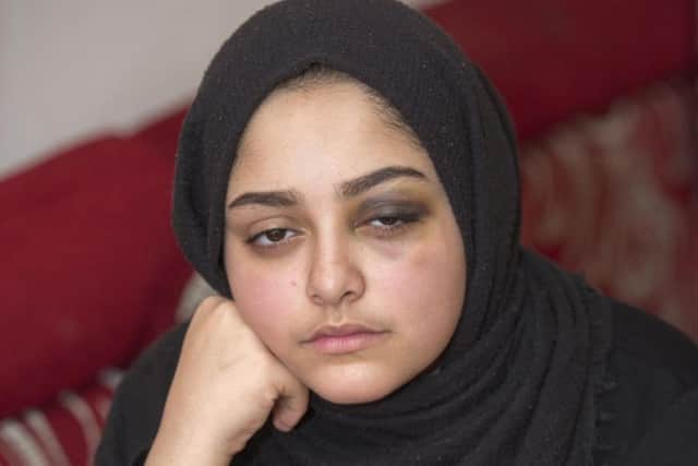 Redana Ali, who said she was strangled with her hijab and punched in the face in a 'racially aggravated attack' while heading home from school.