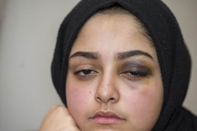 Redana Ali, who said she was strangled with her hijab and punched in the face in a 'racially aggravated attack' while heading home from school.