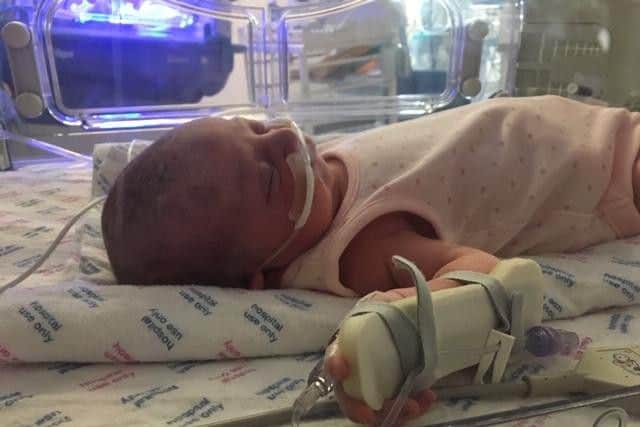 Baby Edie, born with a rare condition which affects just one per cent of children, spent 11 days at Sheffield Children's Hospital.