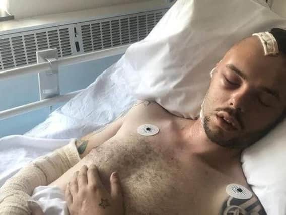 Kieran Lofthouse recovering in hospital from the attack.