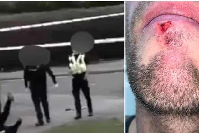 David Baldwin, 31, claims he was pushed to the ground, hit and grabbed around the throat by a West Yorkshire Police officer while filming an incident in Seacroft on Saturday