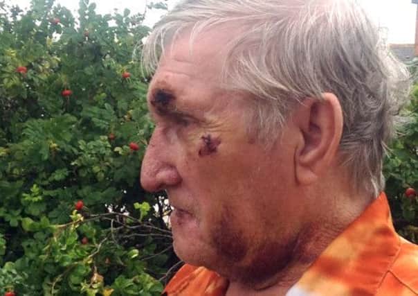 War veteran Barney Alcock was beaten to a pulp by youths outside his home.  Picture: Ross Parry Agency