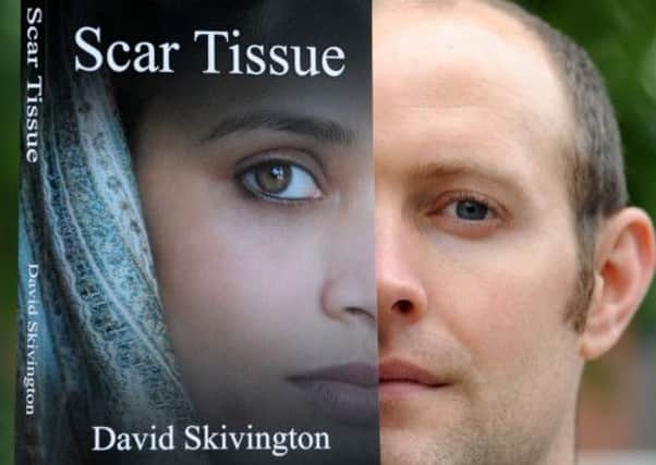 Author David Skivington and his new book 'Scar Tissue'
