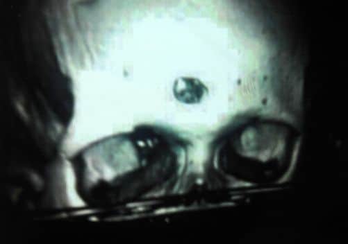 An X-ray of Sheldon Mpofu's skull