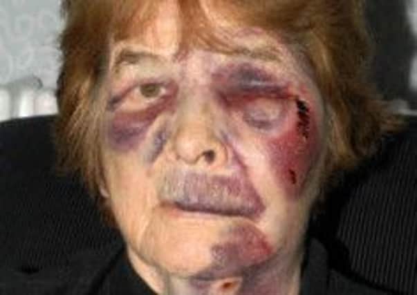Police picture of Sabina Harrison, 78, after she was mugged in Leeds