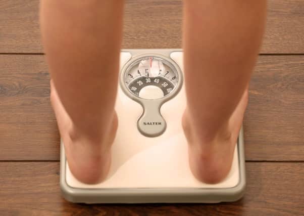 Children whose parents have divorced are more likely to be obese, new research suggests.