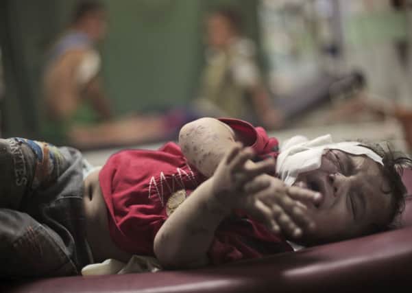 A Palestinian boy cries while receiving treatment for injuries caused by an Israeli strike at a U.N. school in Jebaliya refugee camp