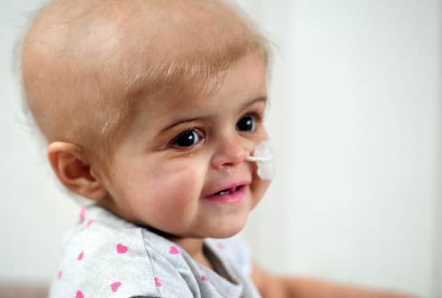 Sixteen-month-old Skye Sutcliffe, whose rare blood cancer has returned and is now incurable