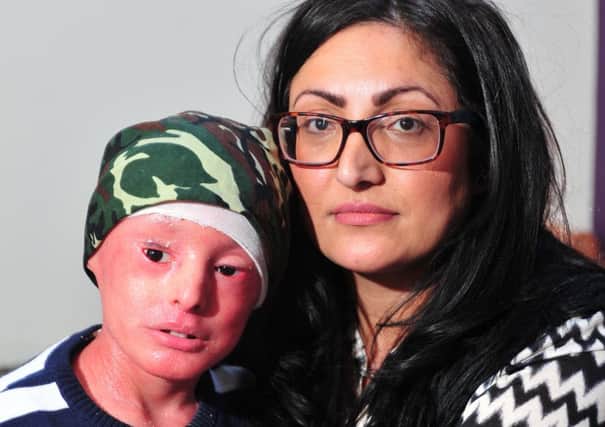 Gulzeab Ahmed with her son Marni, who has rare skin condition Harlequin ichthyosis. Picture by Tony Johnson.