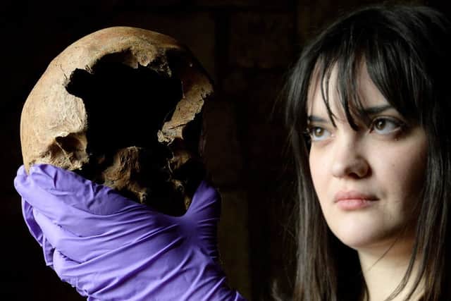 Ruth Whyte, an osteoarchaeologist from York Archaeological Trust, with a skull from a skeleton which is believed to be a Lancastrian soldier executed in York after the Battle of Towton
