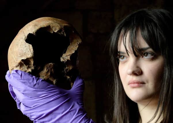 Ruth Whyte, an osteoarchaeologist from York Archaeological Trust, with a skull from a skeleton which is believed to be a Lancastrian soldier executed in York after the Battle of Towton
