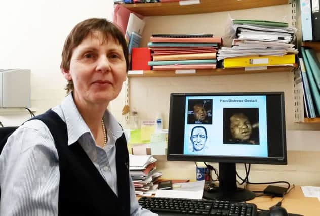 Dr Nadja Reissland from Durham University who has researched scans of unborn babies whose mothers smoke and detected tiny differences in their movements from those whose mothers do not smoke.