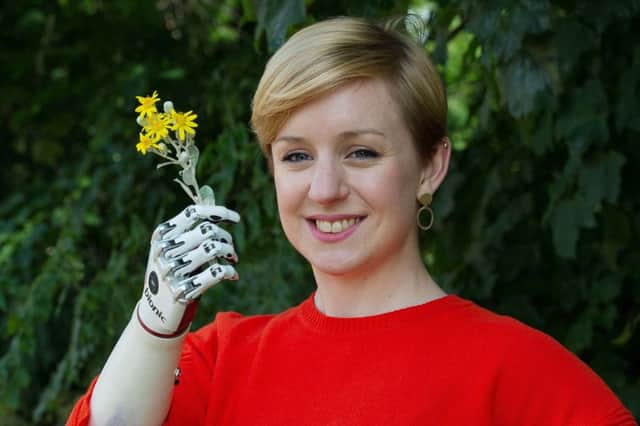 Nicky Ashwell, the UK's first patient to receive a lifelike bionic hand