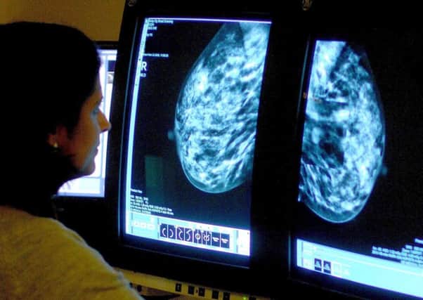 A consultant analyses a mammogram.
Photo: Rui Vieira/PA Wire